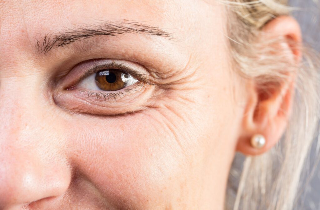 A close up of a person eye that has wrinkles as they smile